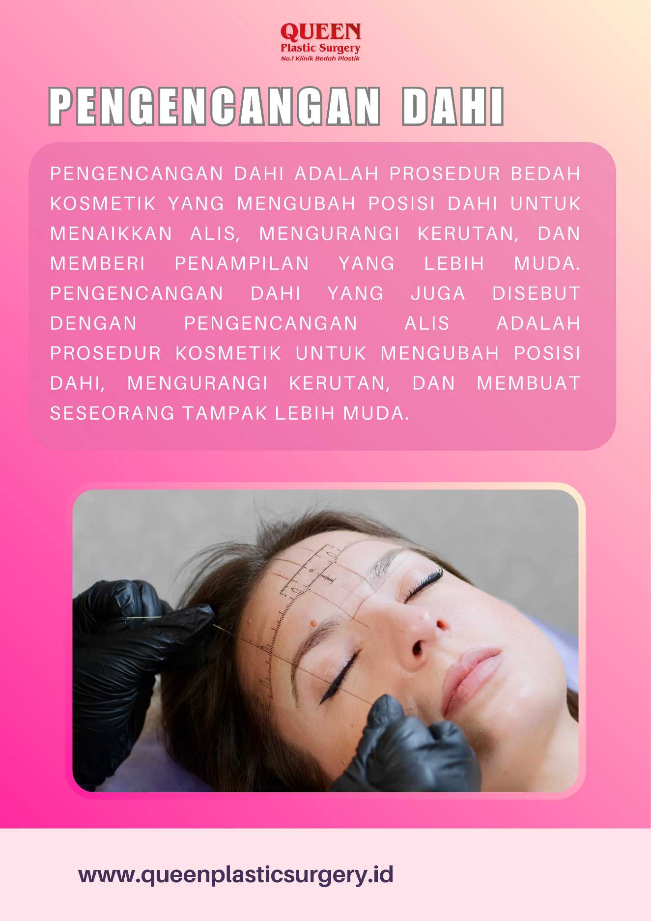 Garis Alis Anda Bermasalah? Pelajari Bagaimana Pengencangan Dahi Dapat Membantu!