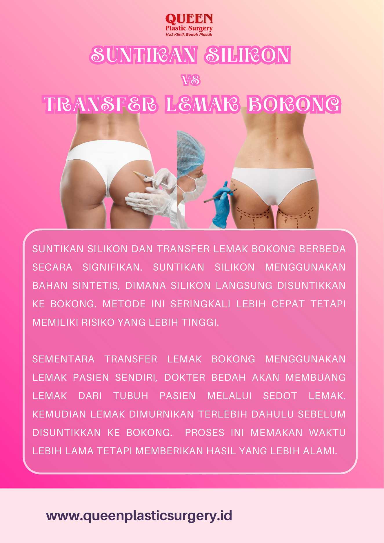 Amankah Suntikan Silikon pada Bokong untuk Jangka Panjang? Temukan Jawabannya di Sini!