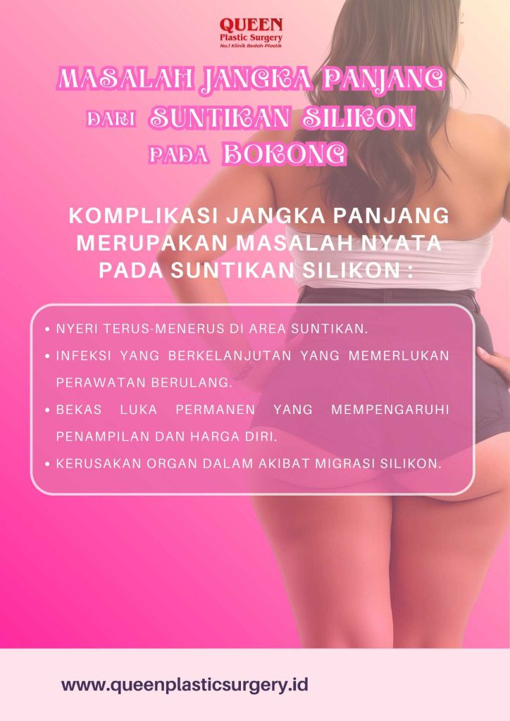 Amankah Suntikan Silikon pada Bokong untuk Jangka Panjang? Temukan Jawabannya di Sini!