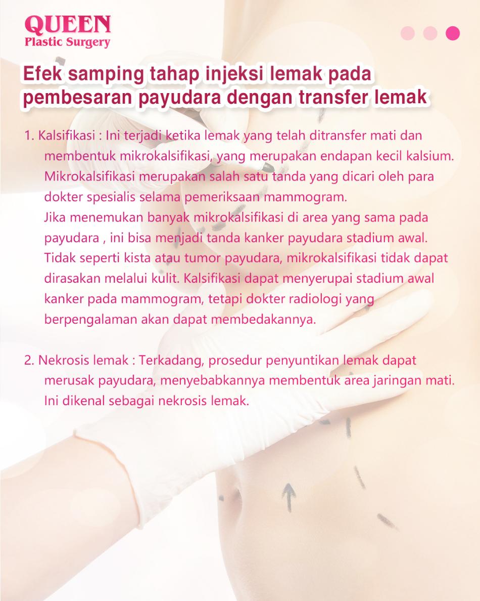 Miliki Payudara Ideal Tanpa Implan: Cara Kerja dan Hasil Optimal Pembesaran Payudara dengan Transfer Lemak
