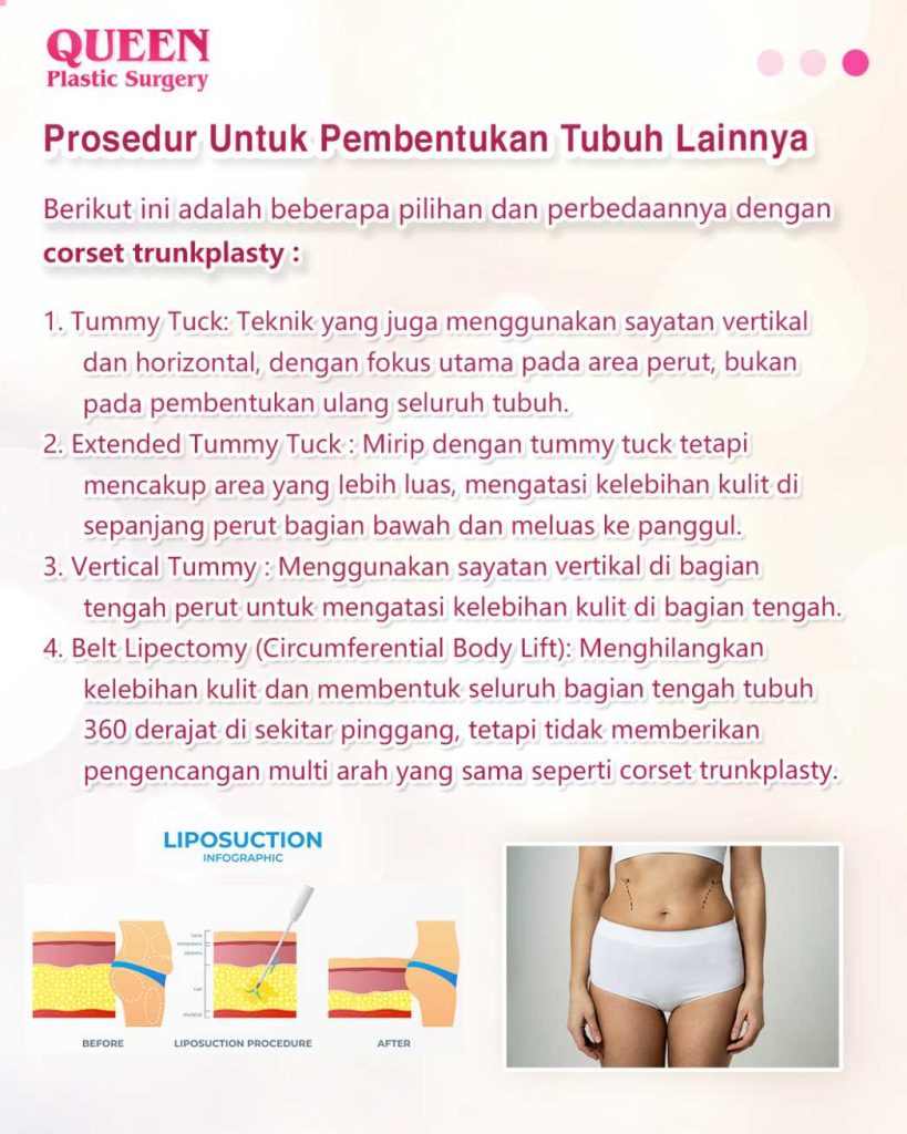 Corset Trunkplasty: Rahasia Tubuh Langsing dan Terbentuk Sempurna yang Wajib Anda Pahami