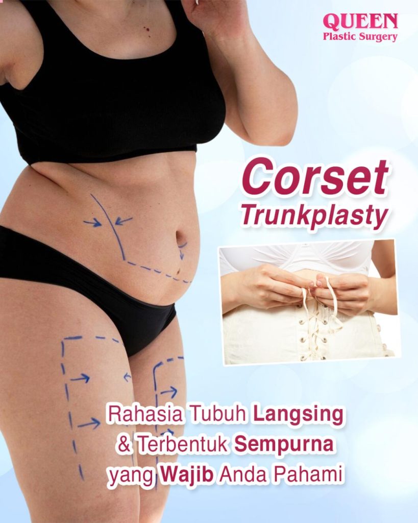 Corset Trunkplasty: Rahasia Tubuh Langsing dan Terbentuk Sempurna yang Wajib Anda Pahami