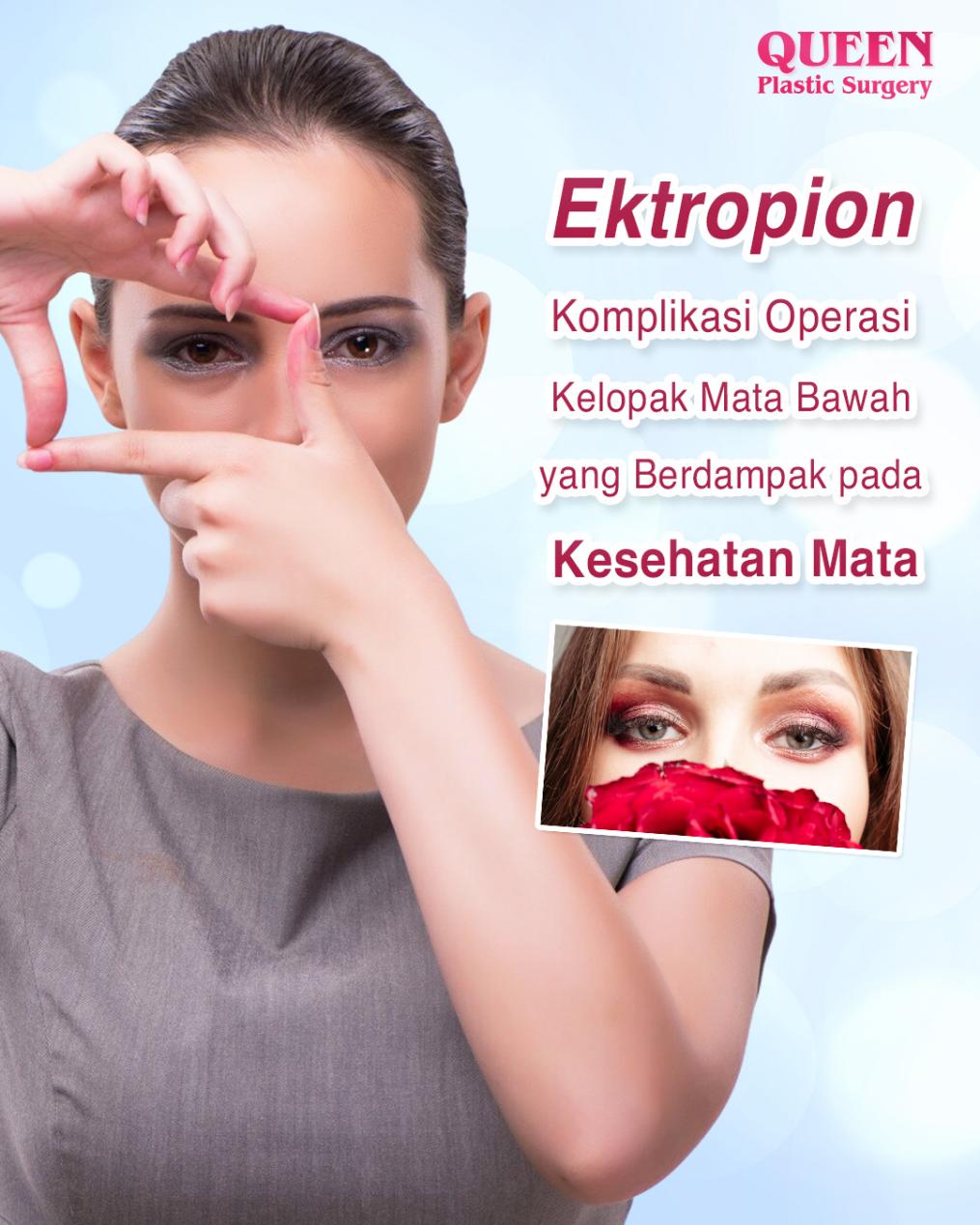 Jangan Anggap Sepele! Kenali Gejala Ektropion Untuk Kelopak Mata Turun