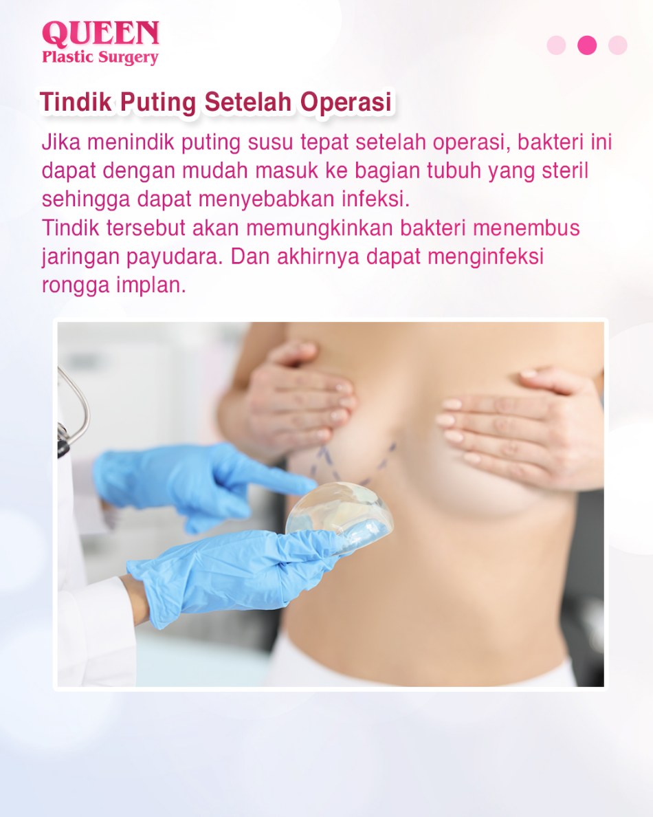 Amankah Tindik Puting Jika Ingin Operasi Payudara? Kupas Tuntas di Sini!