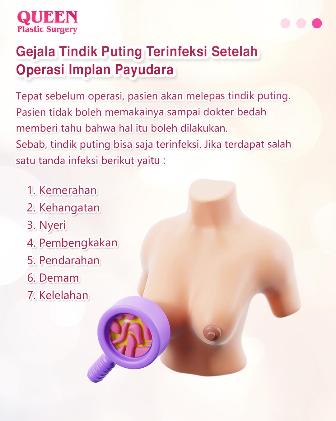 Amankah Tindik Puting Jika Ingin Operasi Payudara? Kupas Tuntas di Sini!
