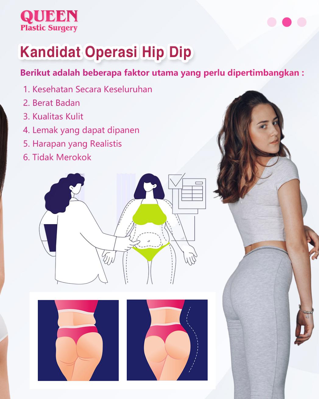 Mengenal Operasi Hip Dip Solusi Efektif untuk Bentuk Panggul Lebih Sempurna