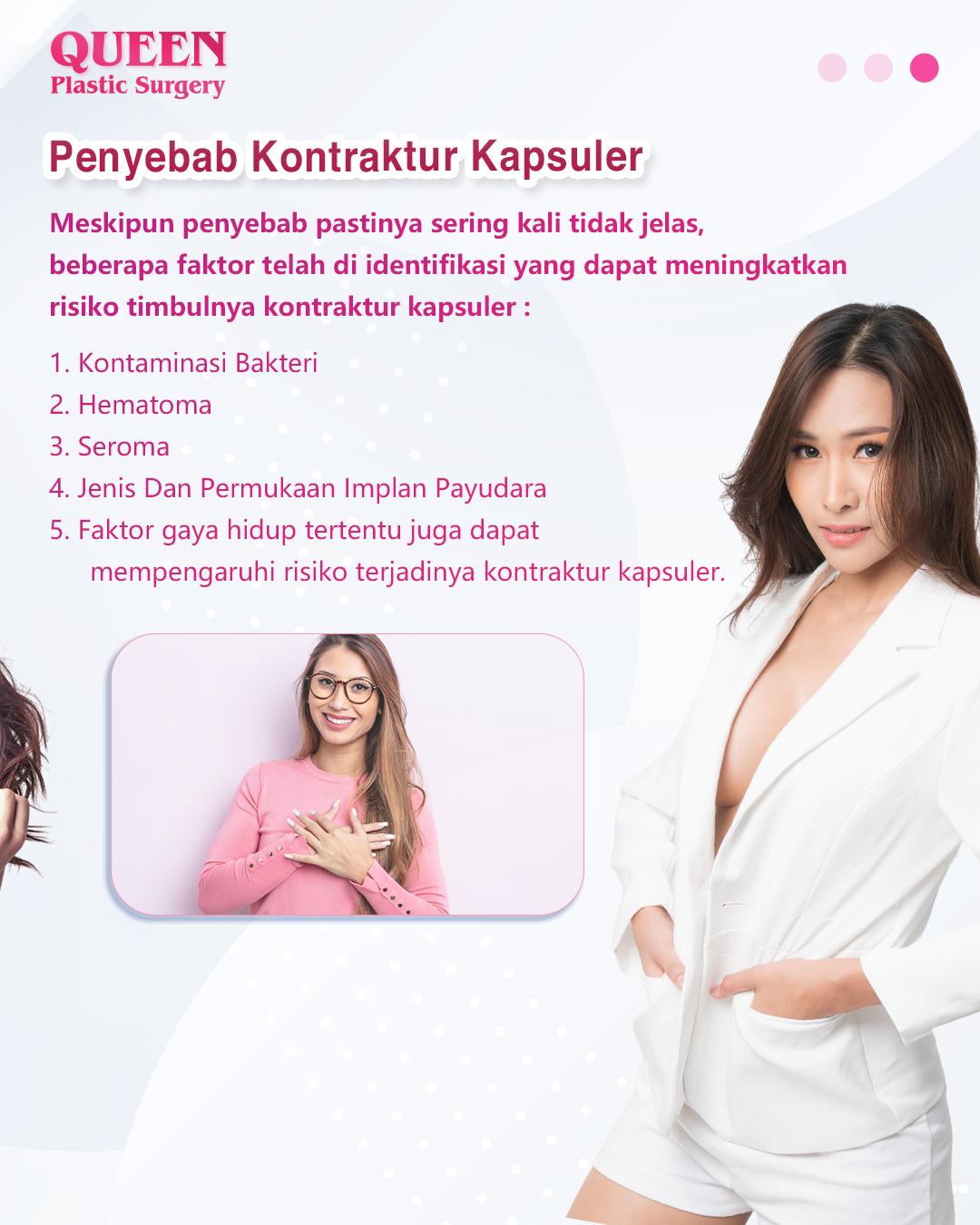 Mengupas Tuntas Kontraktur Kapsuler: Kenali Gejala dan Solusi Penanganannya