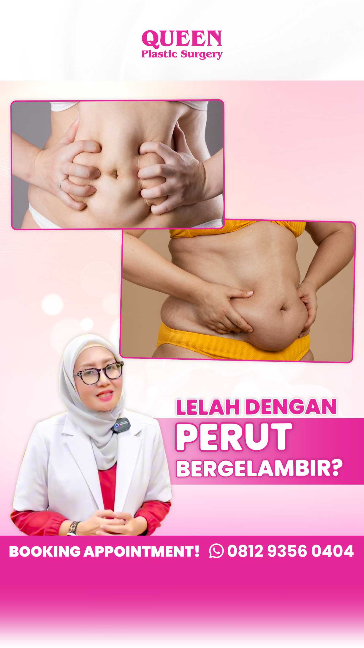 Akankah Kulit Menjadi Kencang Setelah Sedot Lemak? Ini Penjelasan Lengkapnya!