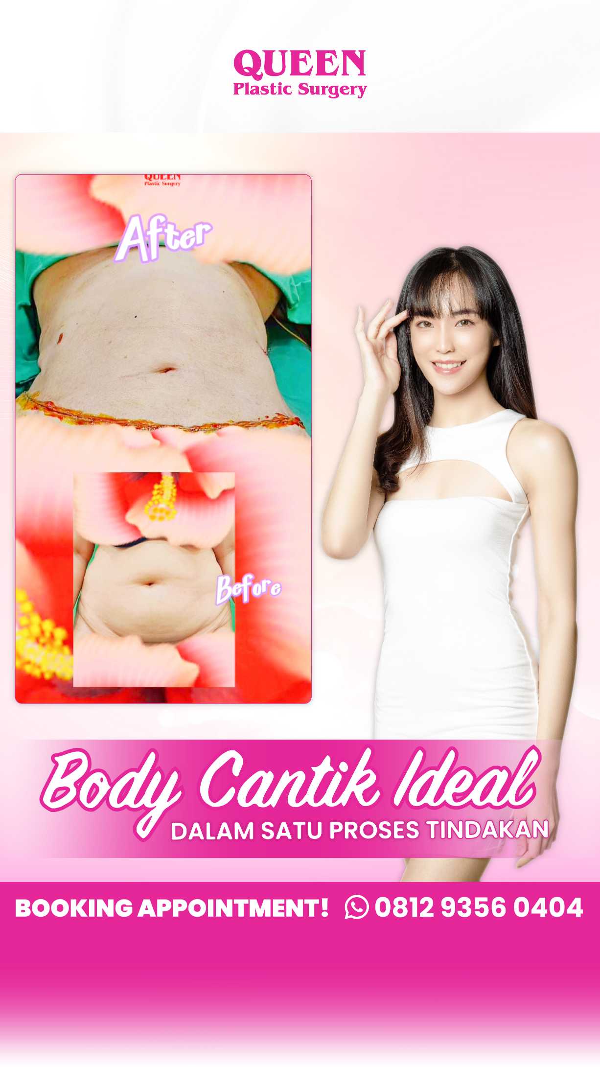 Akankah Kulit Menjadi Kencang Setelah Sedot Lemak? Ini Penjelasan Lengkapnya!