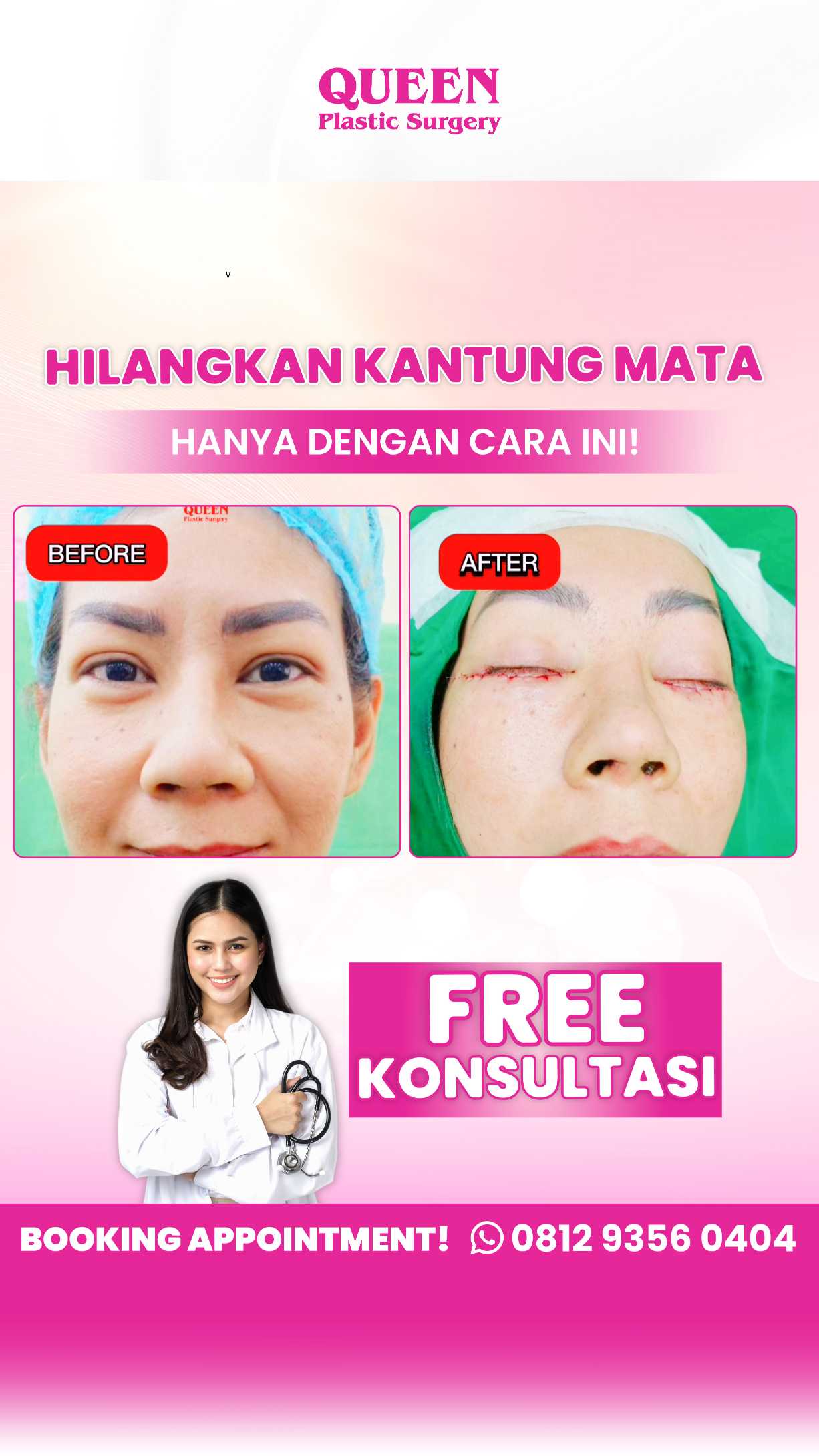 Kantung Mata Mengganggu? Ini Pilihan Perawatan Terbaik, dari Non-Invasif hingga Medis
