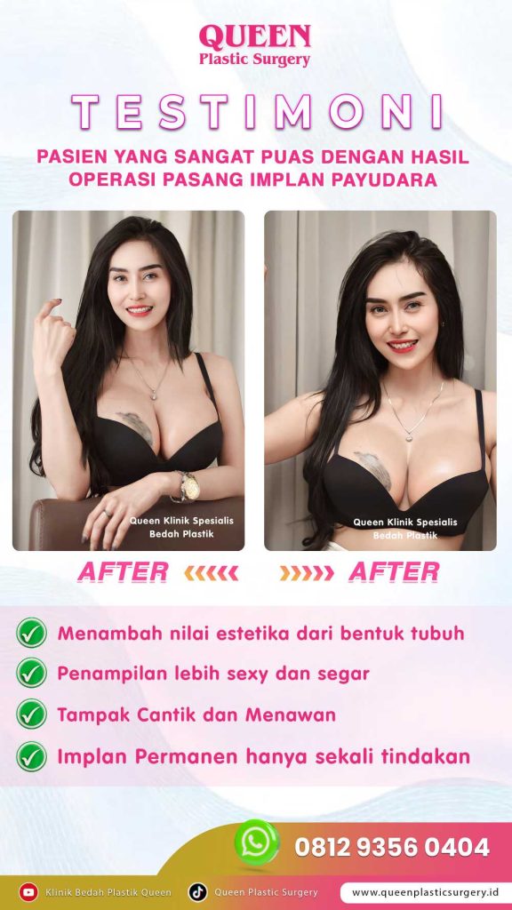 Ingin Pembesaran Payudara Alami? Ini Berbagai Prosedur dan Keunggulannya