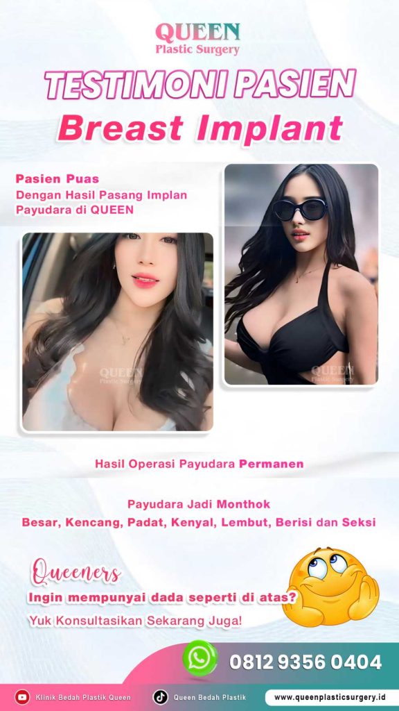 Ingin Pembesaran Payudara Alami? Ini Berbagai Prosedur dan Keunggulannya