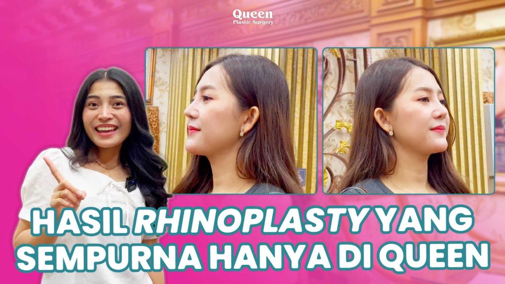 Rhinoplasty Tertutup: Operasi Minimal Invasif untuk Hidung Ideal Tanpa Bekas Luka