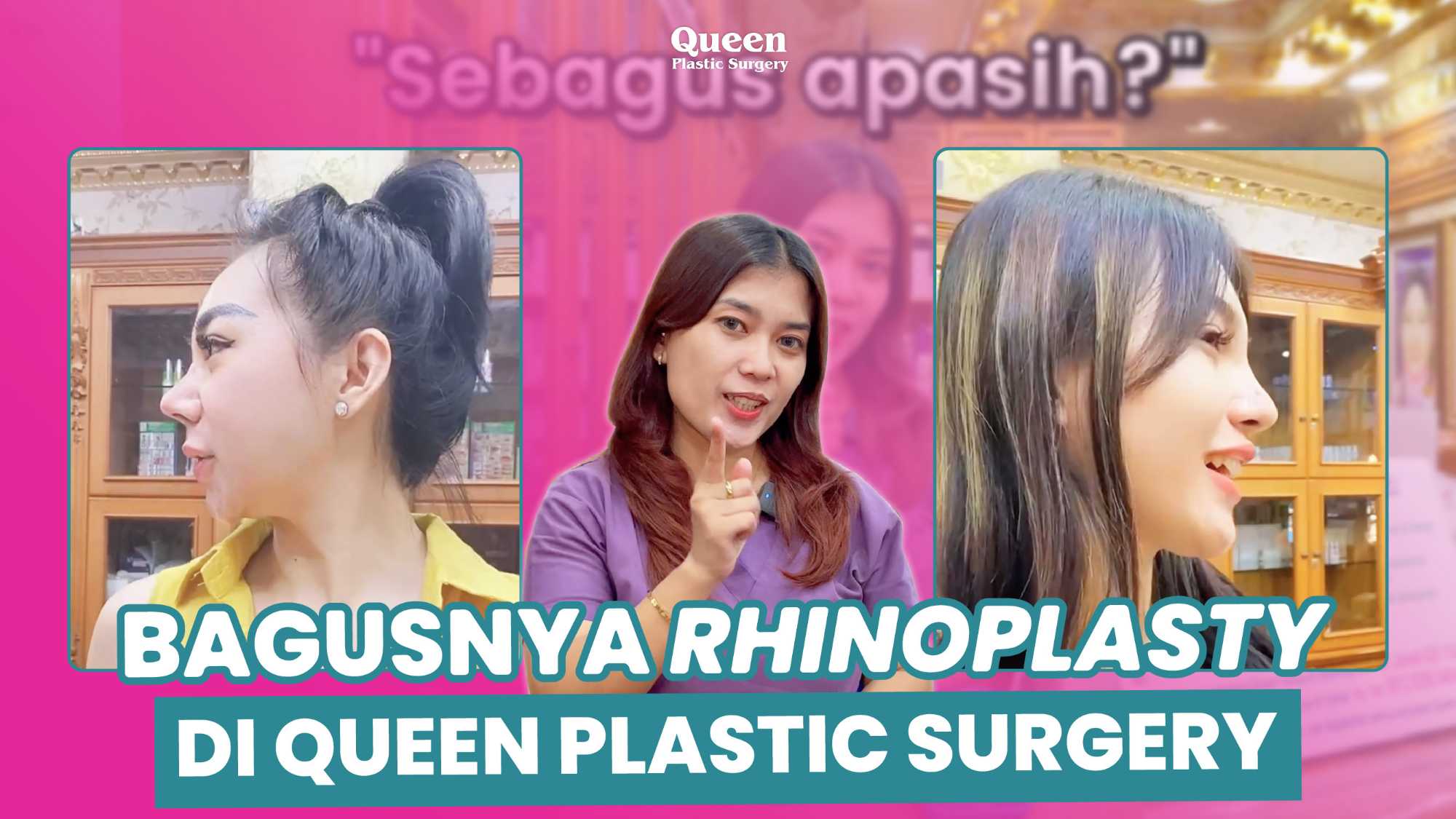 Bukan Hanya Mengubah Bentuk, Tapi Juga Mengubah Ukuran Hidung! Ini Faktanya Tentang Rhinoplasty!