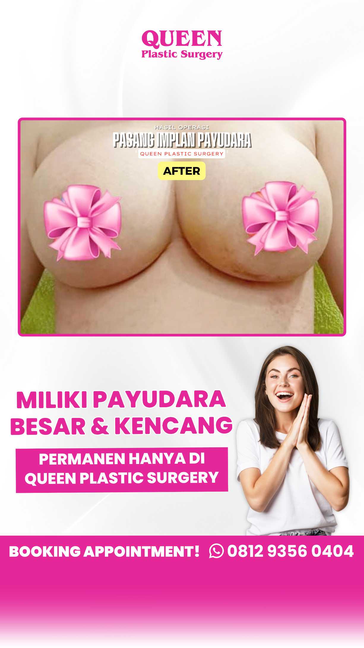 Penyebab Payudara Tuberous (Tubular Breast) dan Solusi Bedah Plastik untuk Mengoreksinya