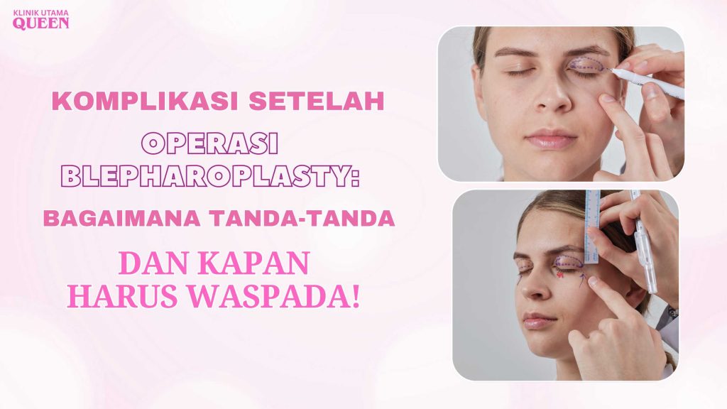 Komplikasi Setelah Operasi Blepharoplasty: Tanda-tanda dan Kapan Harus Waspada