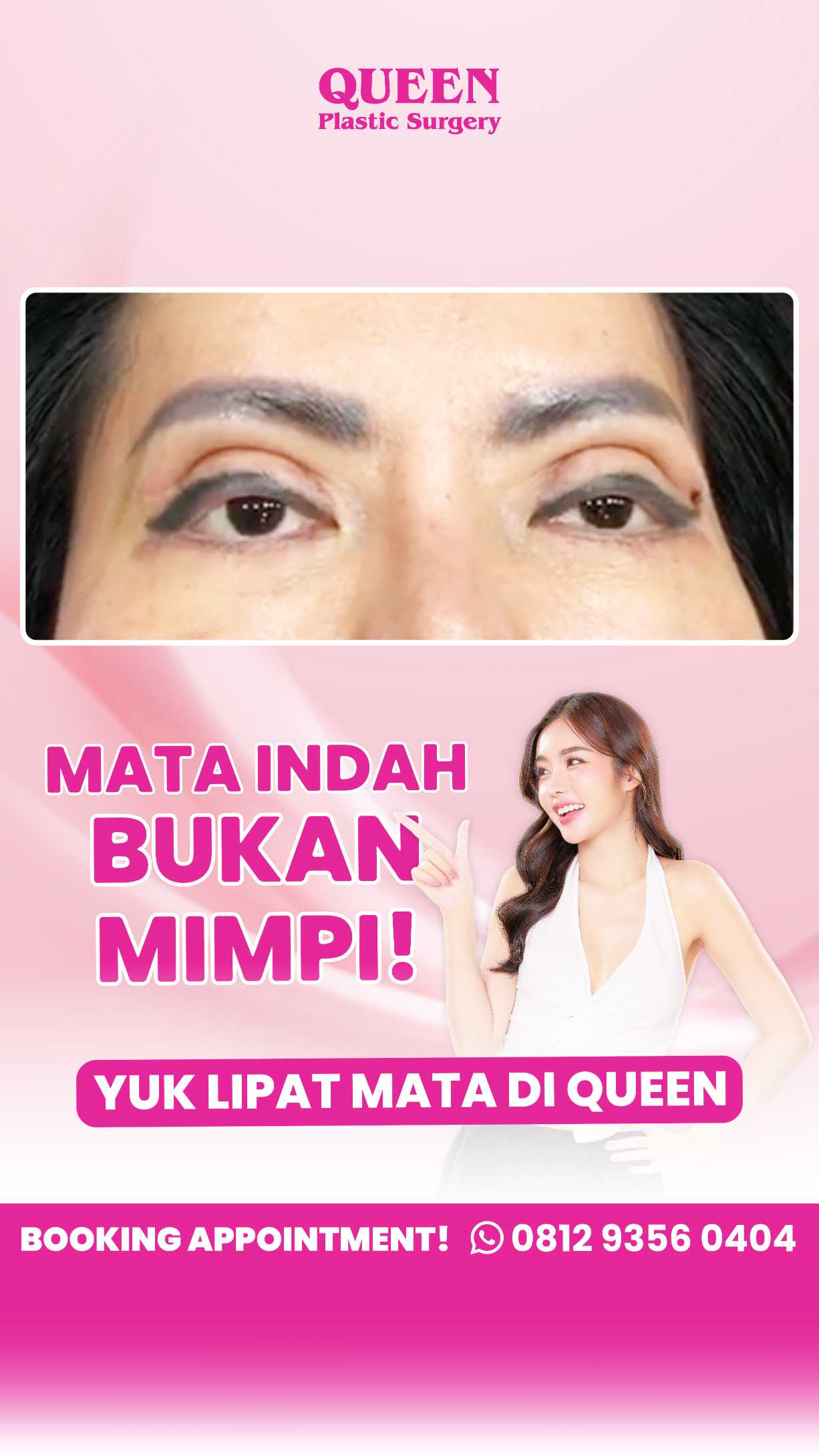 Hasil Operasi Kelopak Mata Tidak Sesuai Ekspektasi? Ini Solusi dan Langkah Tepatnya