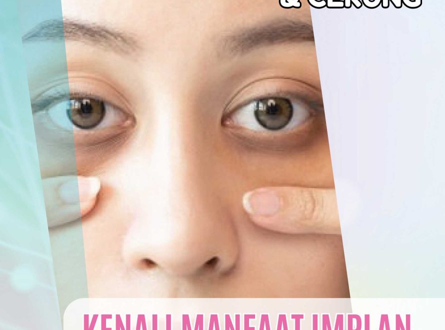 Mata Tampak Lelah dan Cekung? Kenali Manfaat Implan Tepi Infraorbital