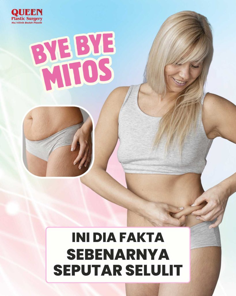 Bye-Bye Mitos: Ini Dia Fakta Sebenarnya Seputar Selulit