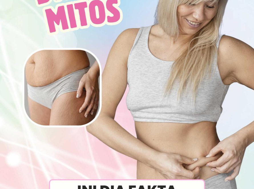 Bye-Bye Mitos: Ini Dia Fakta Sebenarnya Seputar Selulit
