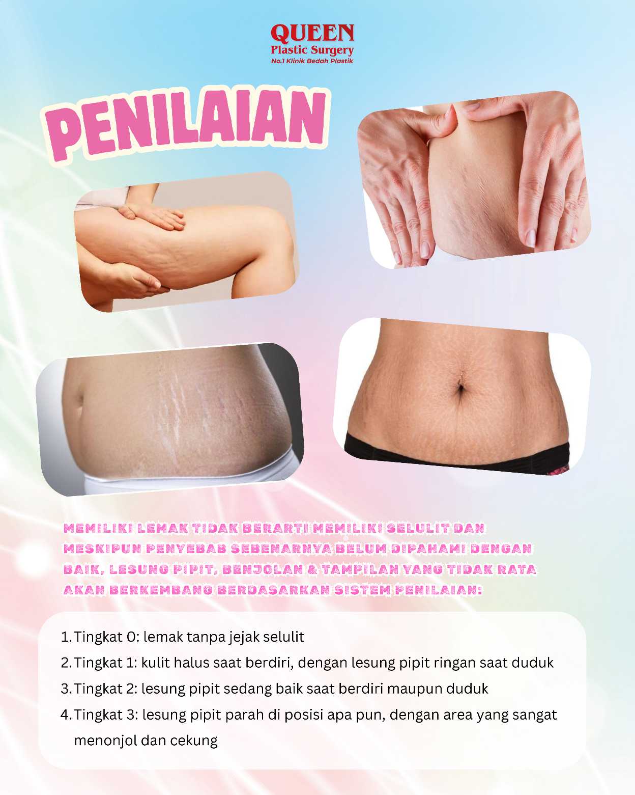 Bye-Bye Mitos: Ini Dia Fakta Sebenarnya Seputar Selulit