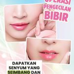 Dapatkan Senyum yang Seimbang dan Sempurna Dengan Operasi Pengecilan Bibir