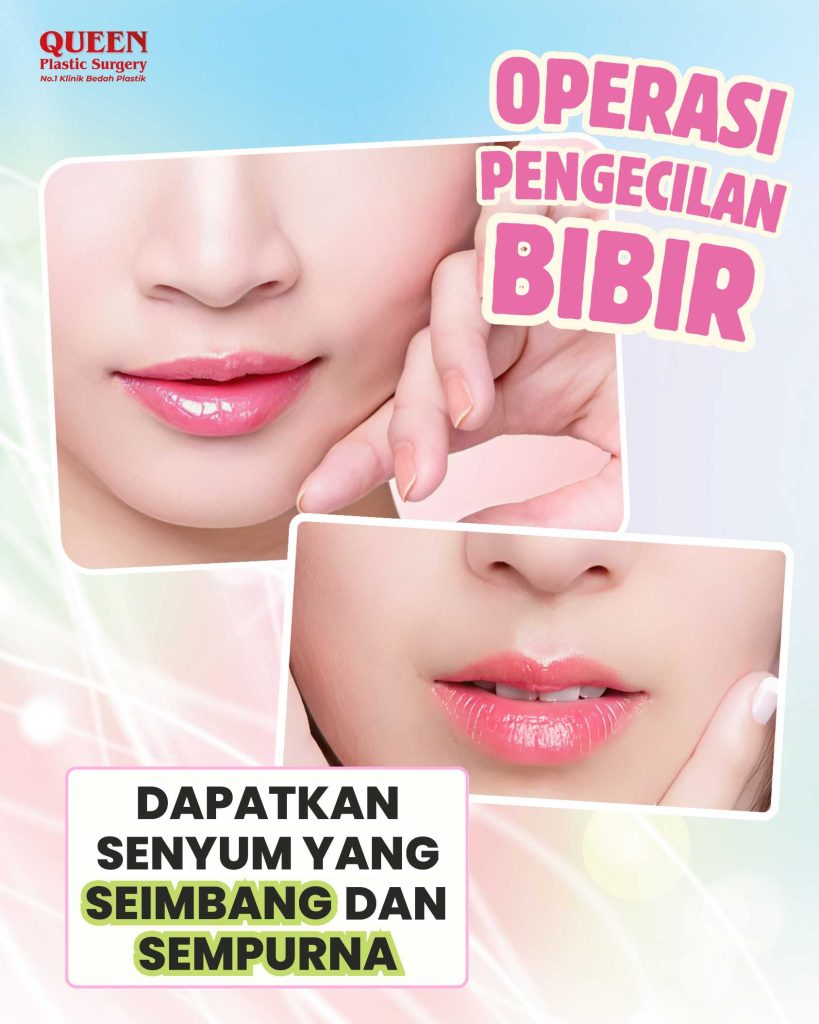 Dapatkan Senyum yang Seimbang dan Sempurna Dengan Operasi Pengecilan Bibir