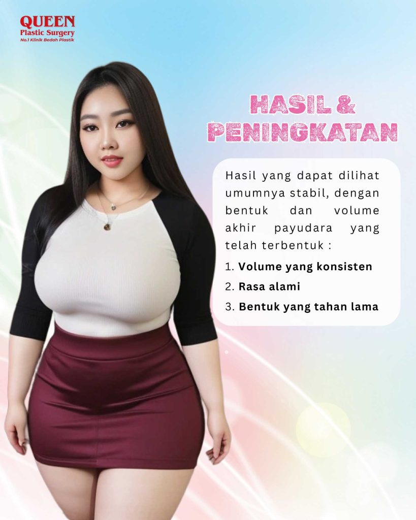 Pembesaran Payudara dengan Transfer Lemak: Bagaimana Hasilnya Setelah 1 Tahun?