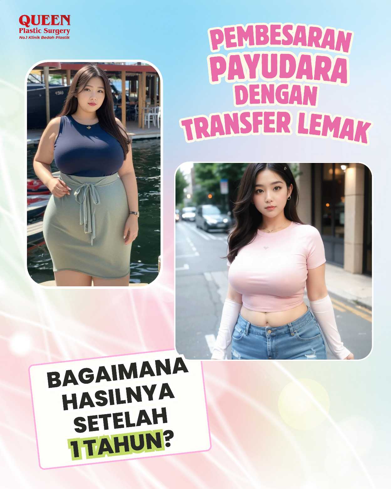 Pembesaran Payudara dengan Transfer Lemak: Bagaimana Hasilnya Setelah 1 Tahun?