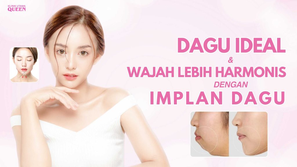 Dagu Ideal & Wajah Lebih Harmonis dengan Implan Dagu
