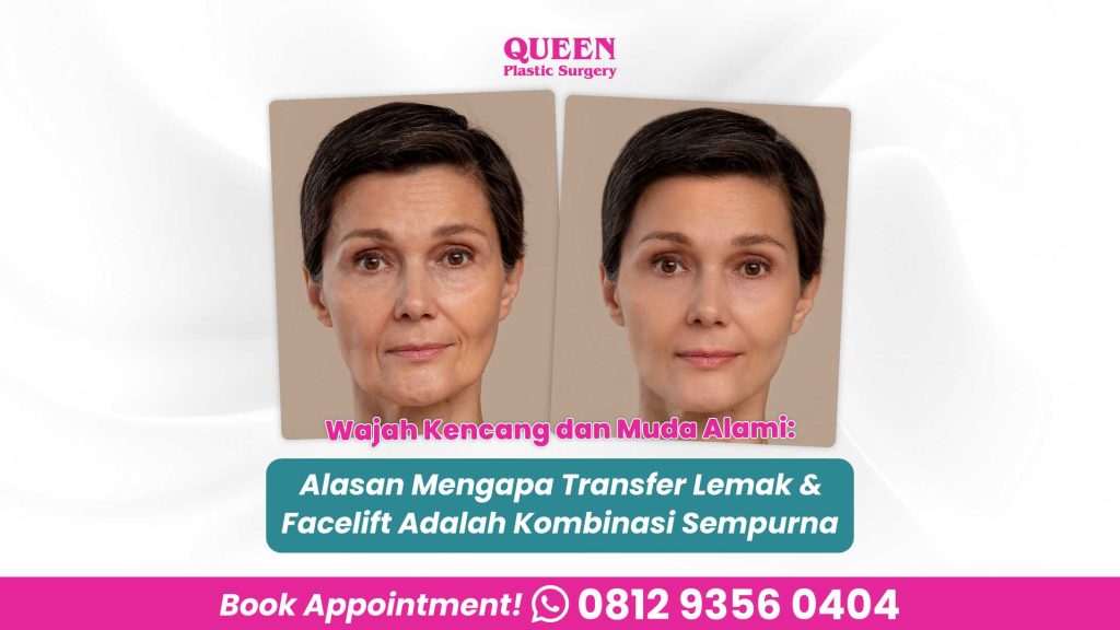 Menggabungkan Transfer Lemak & Operasi Pengencangan Wajah: Rahasia Wajah Kencang & Bervolume Alami