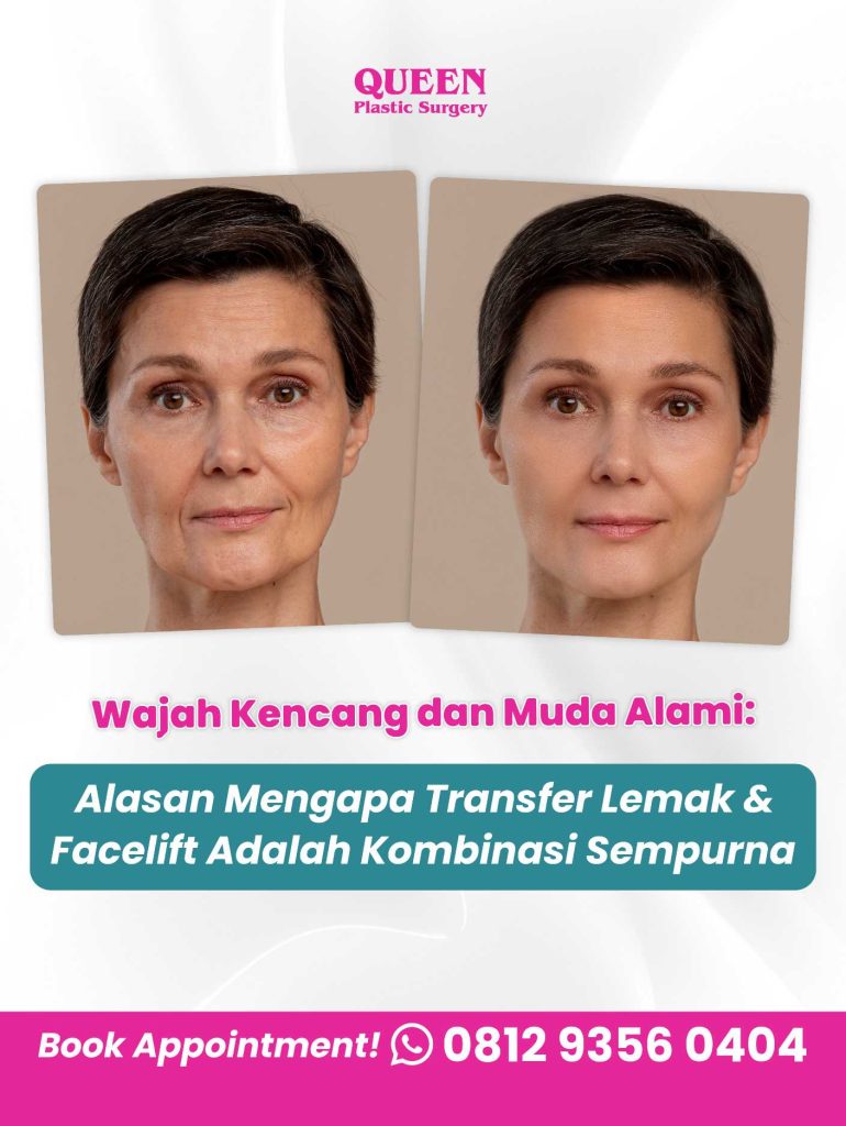 Alasan Mengapa Menggabungkan Transfer Lemak dengan Operasi Pengencangan Wajah Adalah Kombinasi Sempurna
