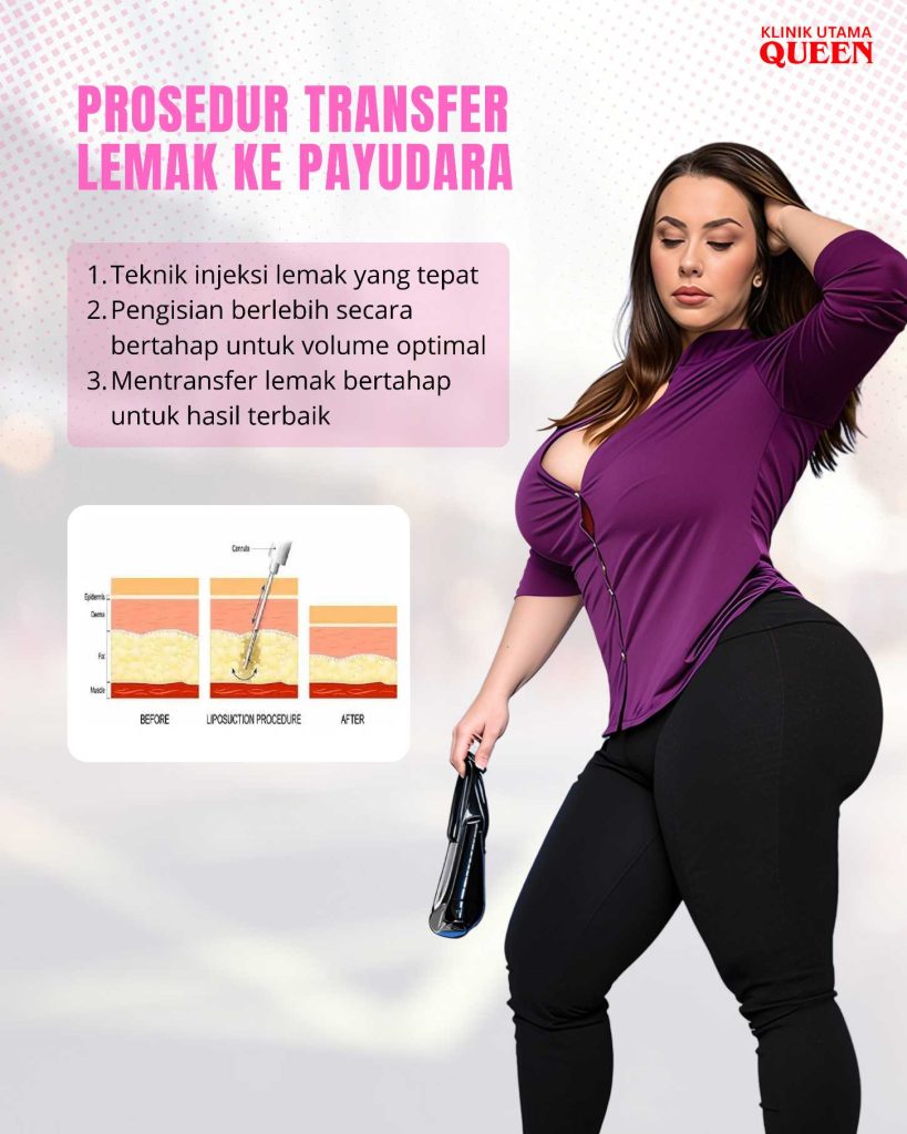 Amankah Pembesaran Payudara Dengan Transfer Lemak Saat Kehamilan dan Menyusui? Ini Fakta yang Perlu Diketahui