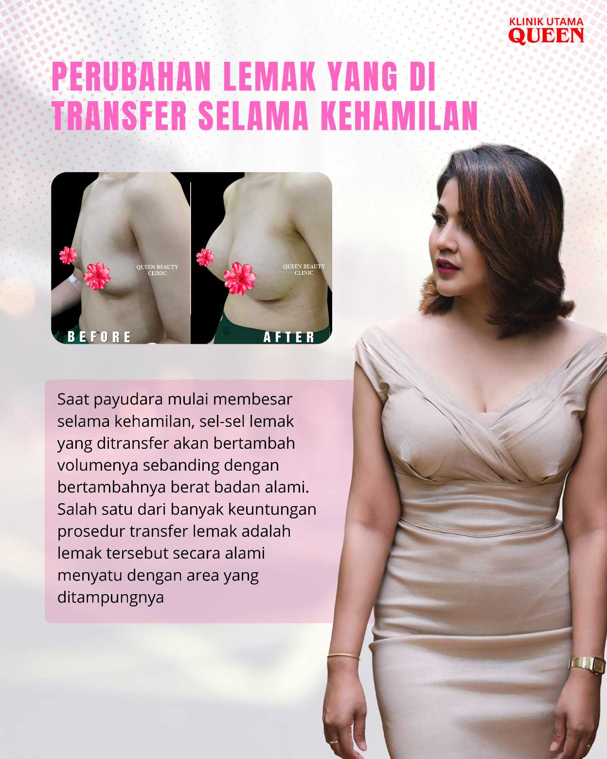 Payudara Kendur Setelah Menyusui? Pengencangan Payudara Dengan Transfer Lemak Menawarkan Solusi Alami dan Aman