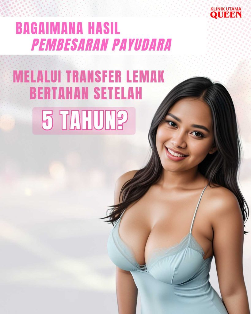 Bagaimana Hasil Pembesaran Payudara Melalui Transfer Lemak Bertahan Setelah 5 Tahun?