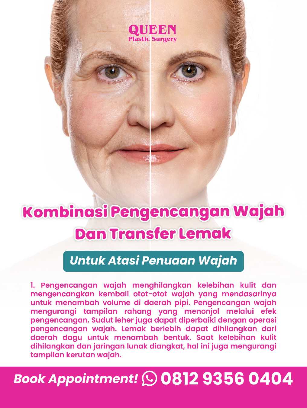 Prosedur Transfer Lemak Wajah untuk Mengatasi Tanda Penuaan