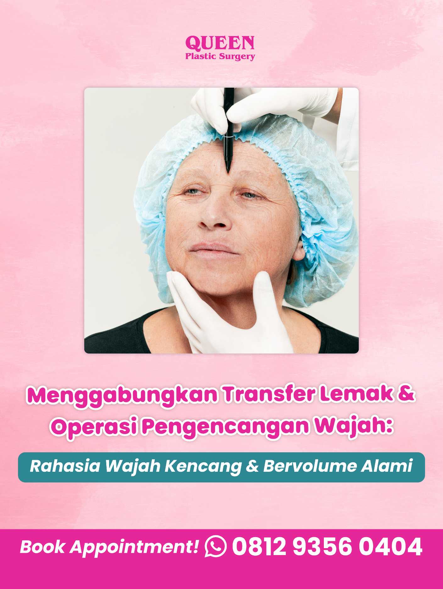 Prosedur Transfer Lemak Wajah untuk Mengatasi Tanda Penuaan