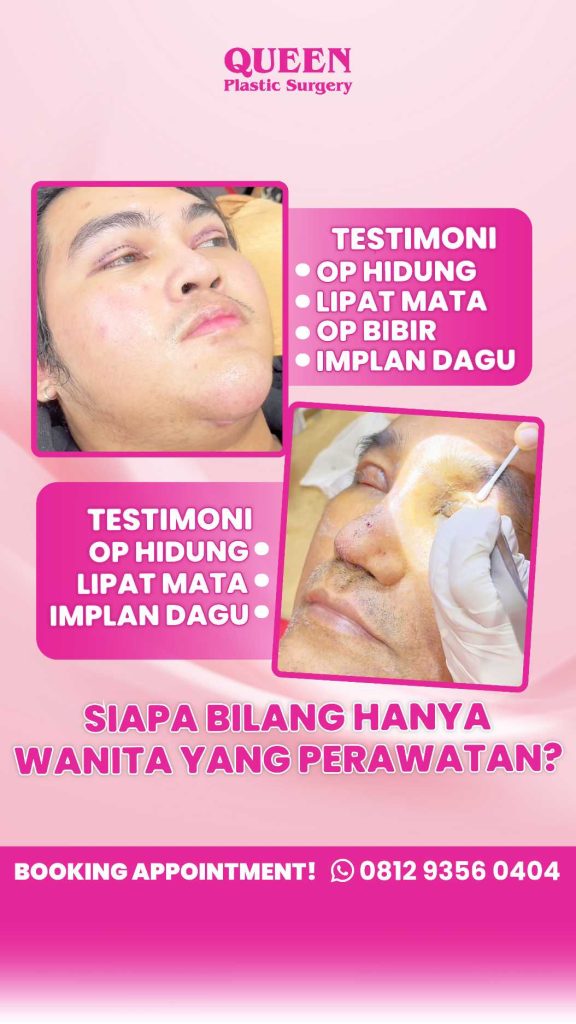 Suntikan Silikon Bikin Bibir Rusak? Ini Solusi Koreksi untuk Mengembalikan Estetika Bibir Anda