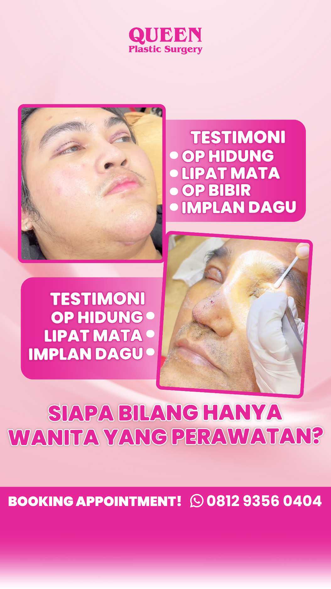 Suntikan Silikon Bikin Bibir Rusak? Ini Solusi Koreksi untuk Mengembalikan Estetika Bibir Anda