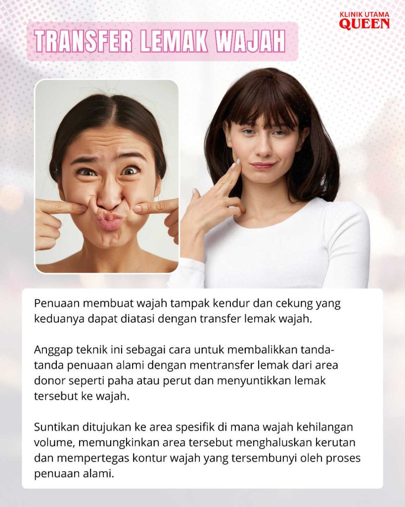 Dari Mengisi Cekungan hingga Mengurangi Garis Halus. Ini Dia Manfaat Transfer Lemak Wajah!