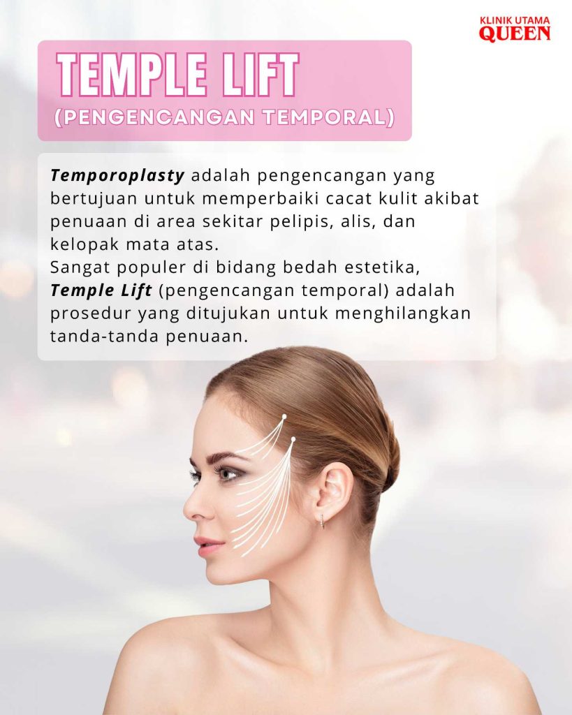 Temple Lift: Rahasia Wajah Awet Muda dengan Pengencangan Area Pelipis