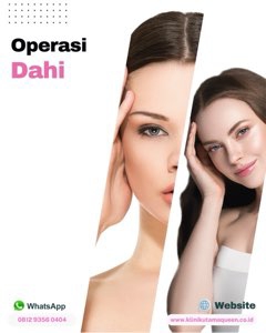 Tampil 10 Tahun Lebih Muda: Rahasia Operasi Pengencangan Alis dan Dahi