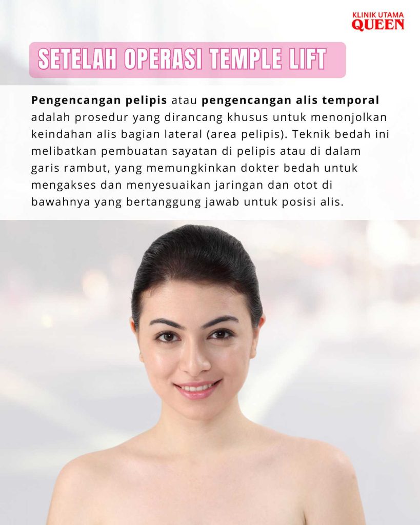Ini Dia Alasan Kuat Mengapa Anda Perlu Pertimbangkan Operasi Pengencangan Pelipis (Forehead Lift)