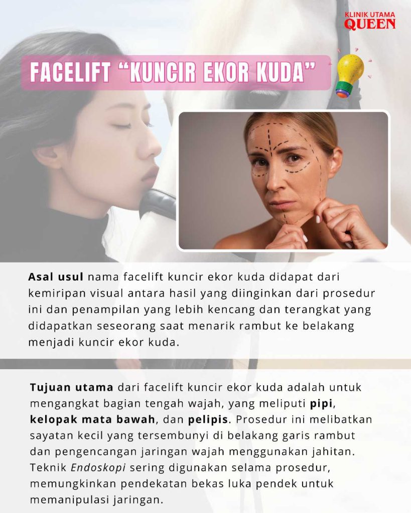 Facelift "Kuncir Ekor Kuda": Rahasia Wajah Kencang dan Tirus Tanpa Bekas Luka Terlihat