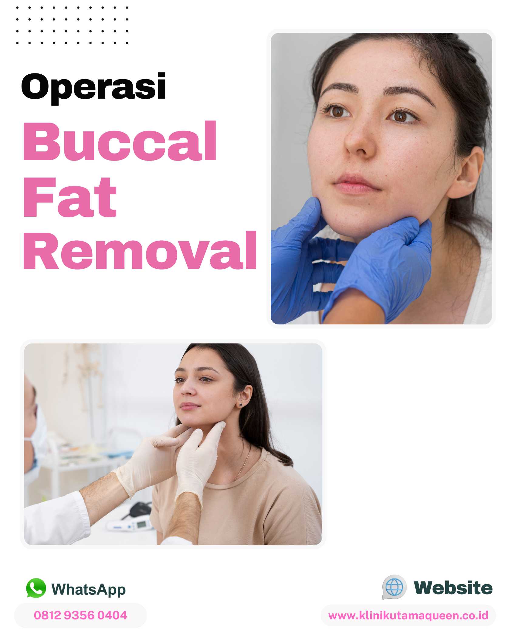 Bye-Bye Pipi Chubby! Merampingkan Wajah Bulat dengan Operasi Pengangkatan Lemak Pipi