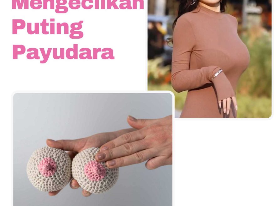 Penyebab Payudara Tuberous (Tubular Breast) dan Solusi Bedah Plastik untuk Mengoreksinya