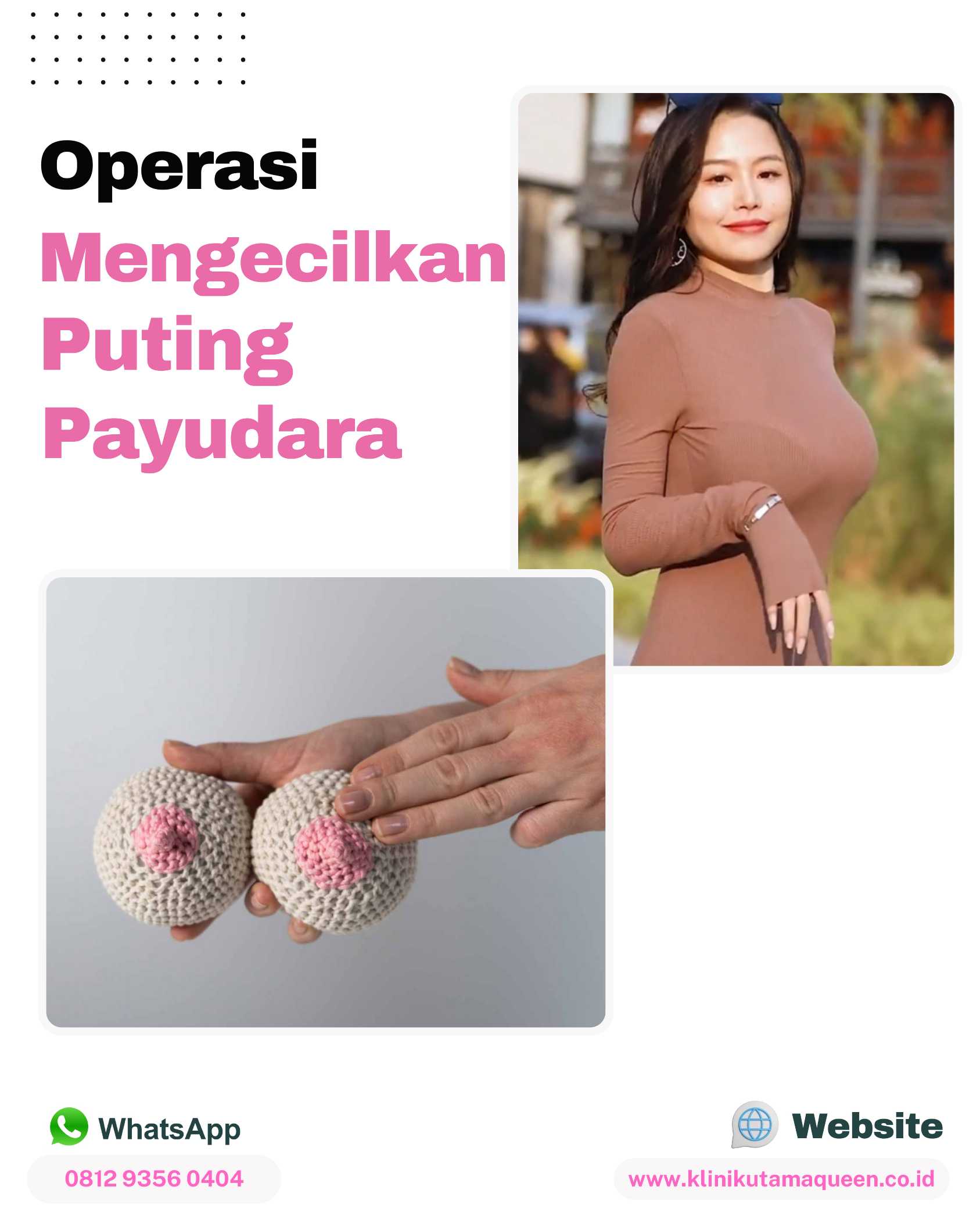 Penyebab Payudara Tuberous (Tubular Breast) dan Solusi Bedah Plastik untuk Mengoreksinya