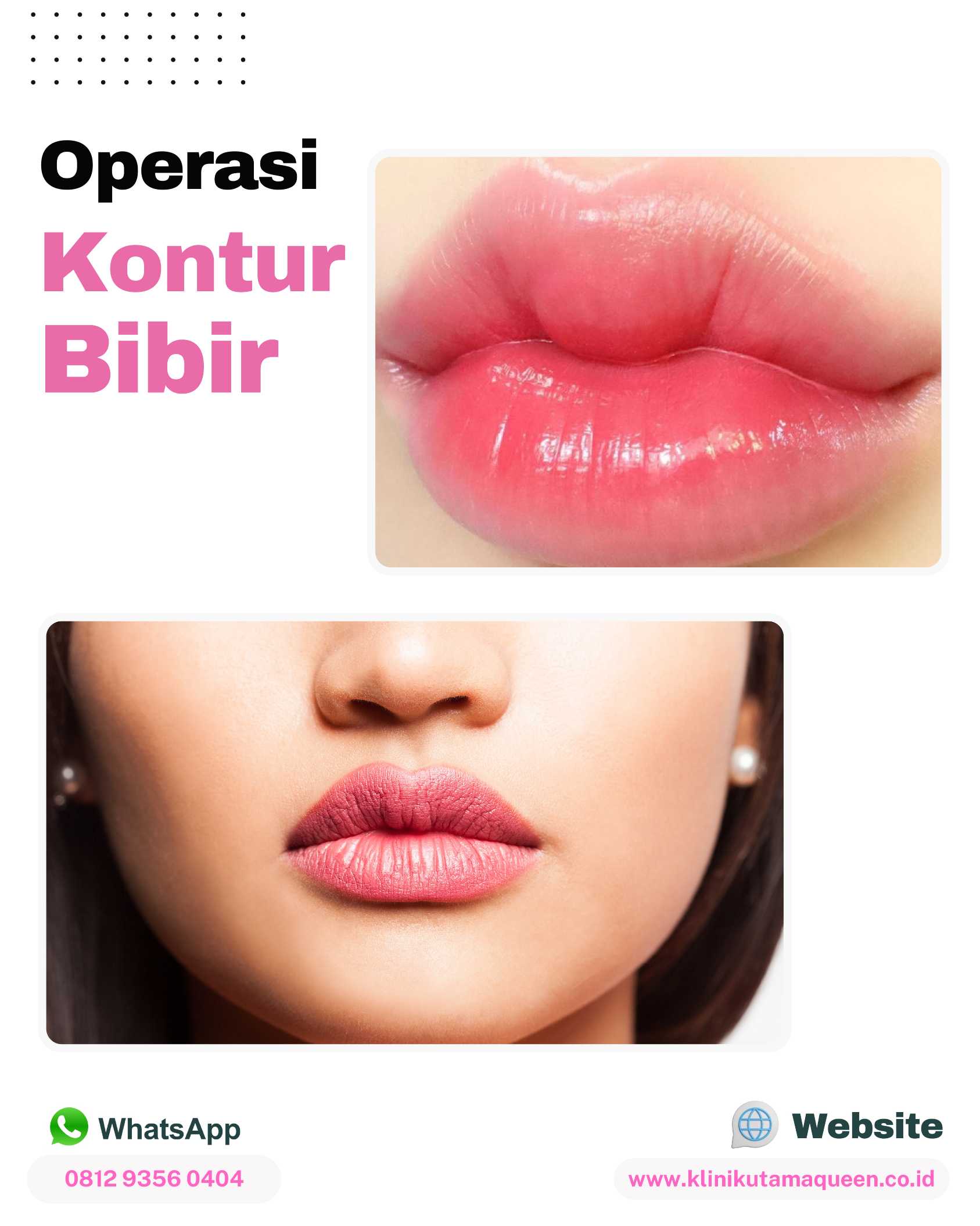 Suntikan Silikon Bikin Bibir Rusak? Ini Solusi Koreksi untuk Mengembalikan Estetika Bibir Anda