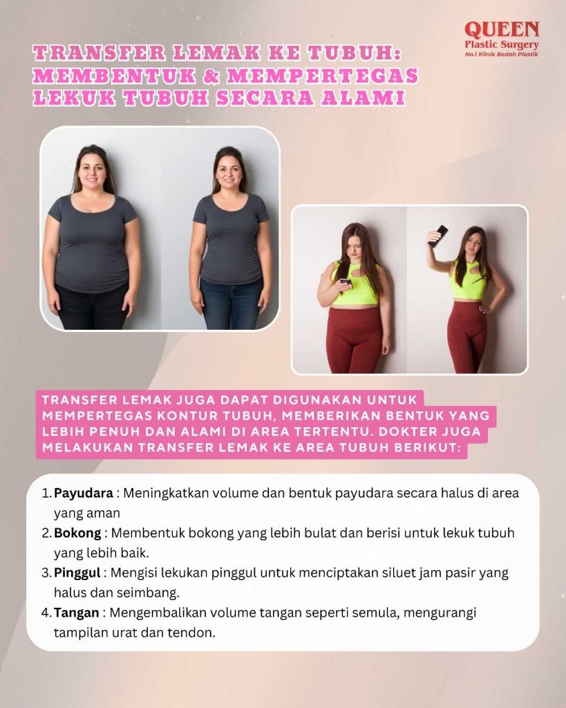 Di Mana Saja Transfer Lemak Bisa Dilakukan? Kenali Area Target Idealnya!
