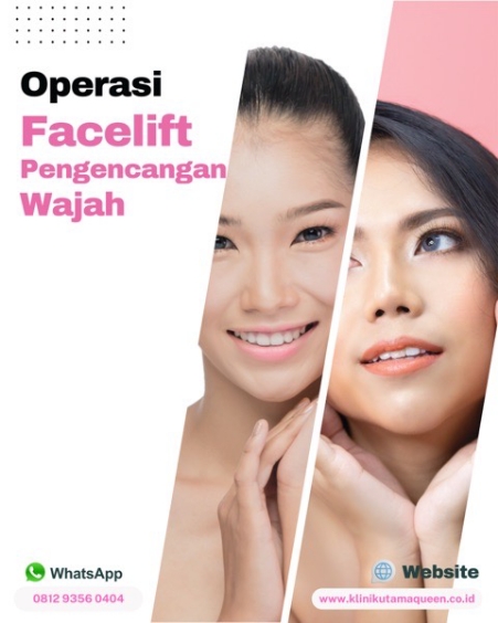 Berapa Kali Facelift Bisa Dilakukan? Ini Batas Amannya! Cek di Sini!